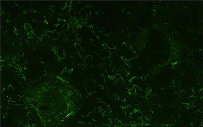 Bovine Leptospirosis Due to Persistent Renal Carriage of Leptospira borgpetersenii Serovar Tarassovi